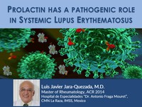Prolactin has a pathogenic role in systemic lupus erythematosus